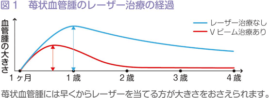 苺状血管腫のレーザー治療の経過