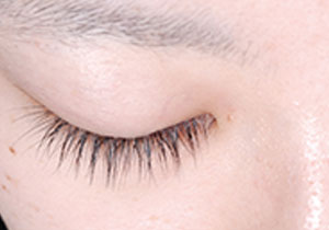 施術後image