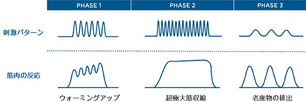 HIFEM技術の刺激パターンimage