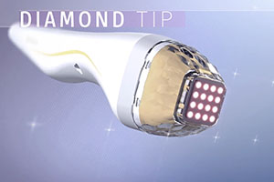 自費診療［POTENZA®【ポテンツァ】（マイクロニードルRF治療機器