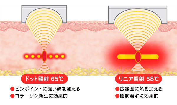 ドット照射とリニア照射概念図