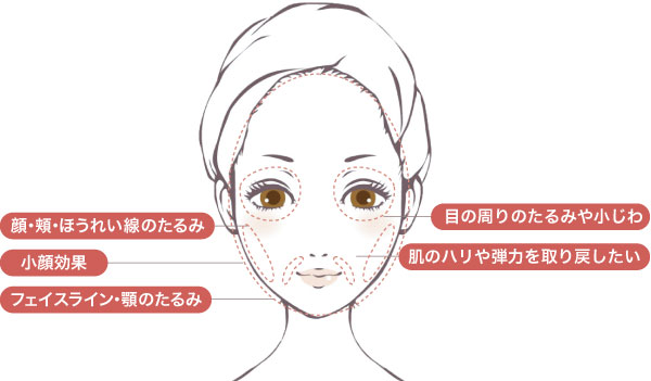 ボルニューマー（Volnewmer®）で改善できる症状シェーマ