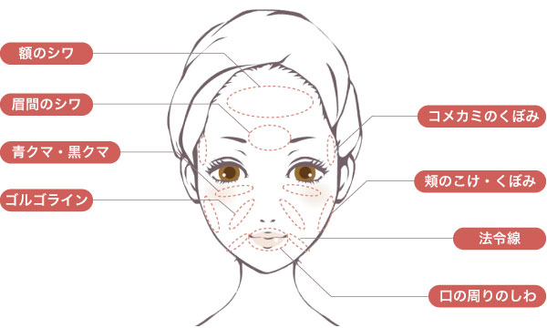 ベビーコラーゲン注入で改善できる症状image