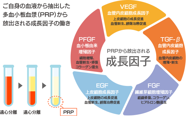 PRP皮膚再生療法の仕組みimage