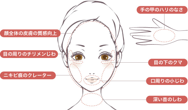 ジュベルック・レニスナで改善できる症状シェーマ