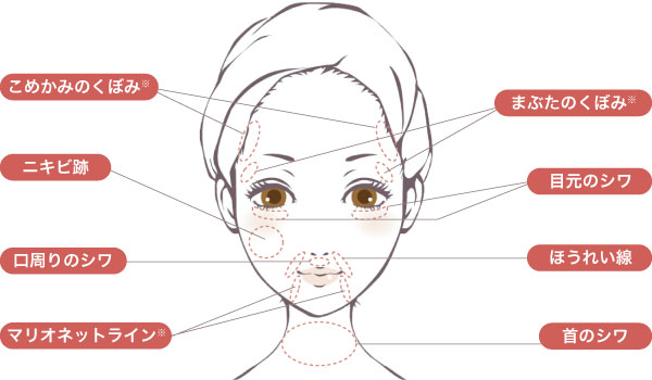 PRP療法、PRPF皮膚再生療法で改善できる症状シェーマ