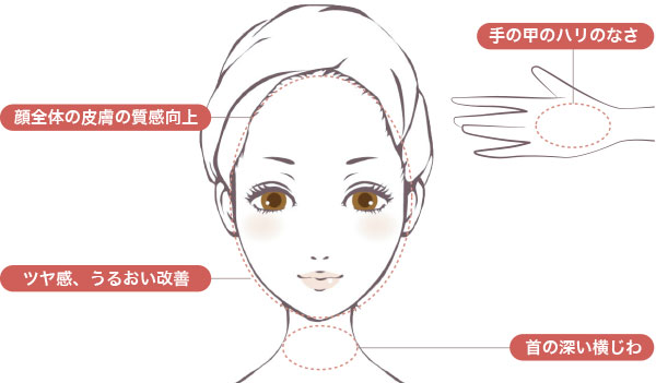 プルリアル バイオスカルプチャーで改善できる症状シェーマ