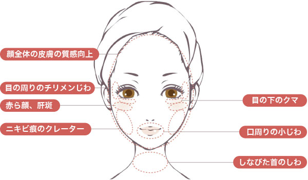 プルリアル デンシフィアで改善できる症状シェーマ