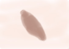 赤ちゃん・子どもの茶あざ